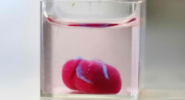 The Future of Cardiology: First 3D-Printed Heart with Human Tissue and Vessels
